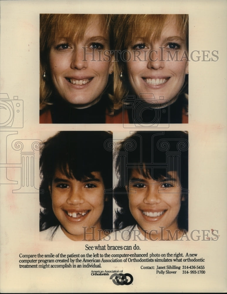 1980 Press Photo Computer-enhanced side-by-side photos of dental patients - Historic Images