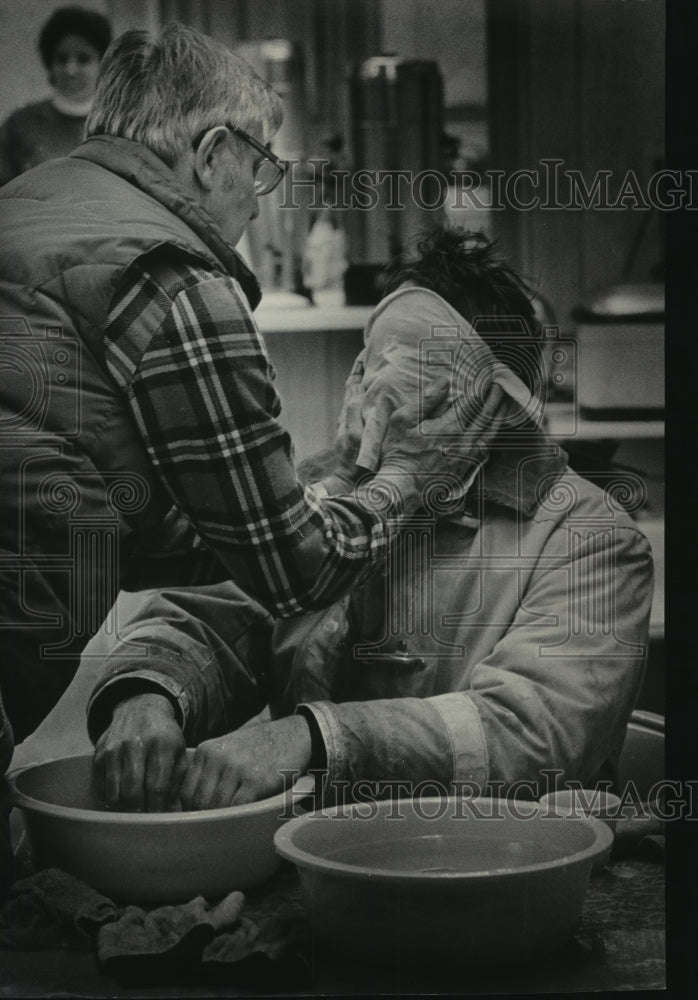 1983 Russ Gale applies Warm Water to Face of Jim Manke, Firefighter-Historic Images