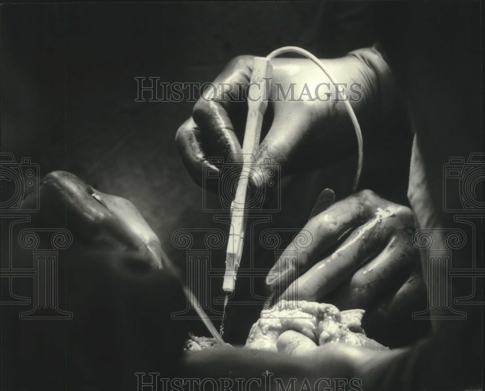1983 Surgery at Froedtert Memorial Lutheran Hospital Wisconsin-Historic Images