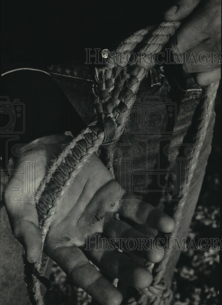 1985 Mark Snow shows blisters from using rope at Rodeo, Wisconsin - Historic Images
