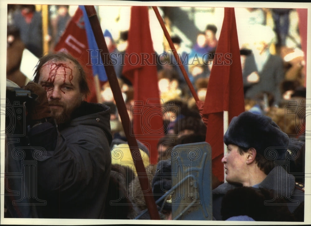 1992, Bloodied Pro-Communist Demonstrator Hangs Onto Truck in Moscow - Historic Images