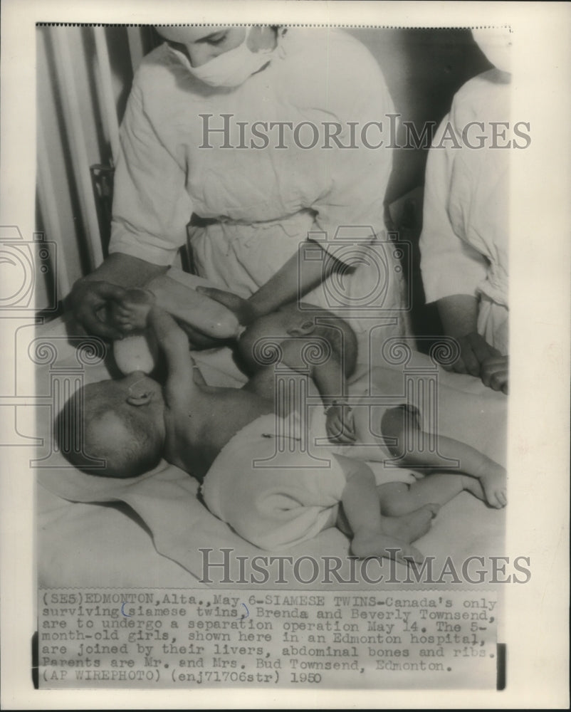 1950 Press Photo Nurse feeds Brenda and Beverly Townsend, Siamese twins, Canada. - Historic Images