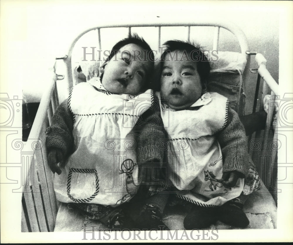 1982 Siamese Twins Xu Jinglian and Xu Jinghua in Shanghai, China - Historic Images
