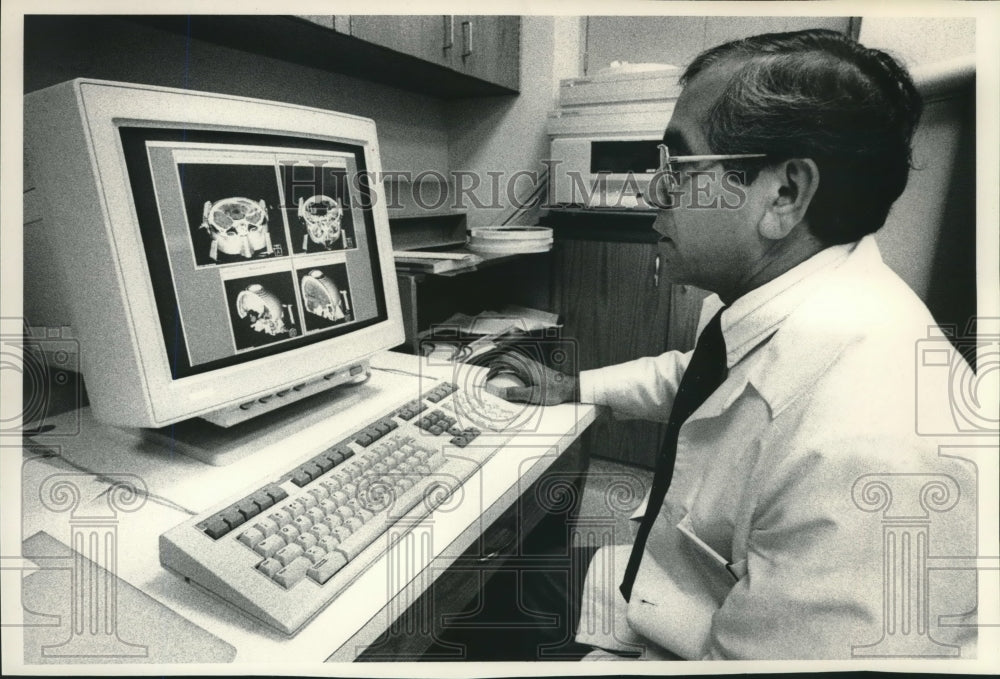 1990 Press Photo Bhudatt Paliwal at the University of Wisconsin Cancer Center - Historic Images