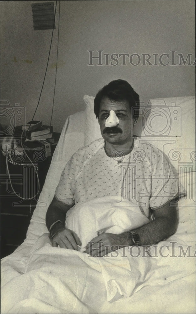 1981 Press Photo James Schoemperlen in St. Francis Hospital after nose surgery - Historic Images