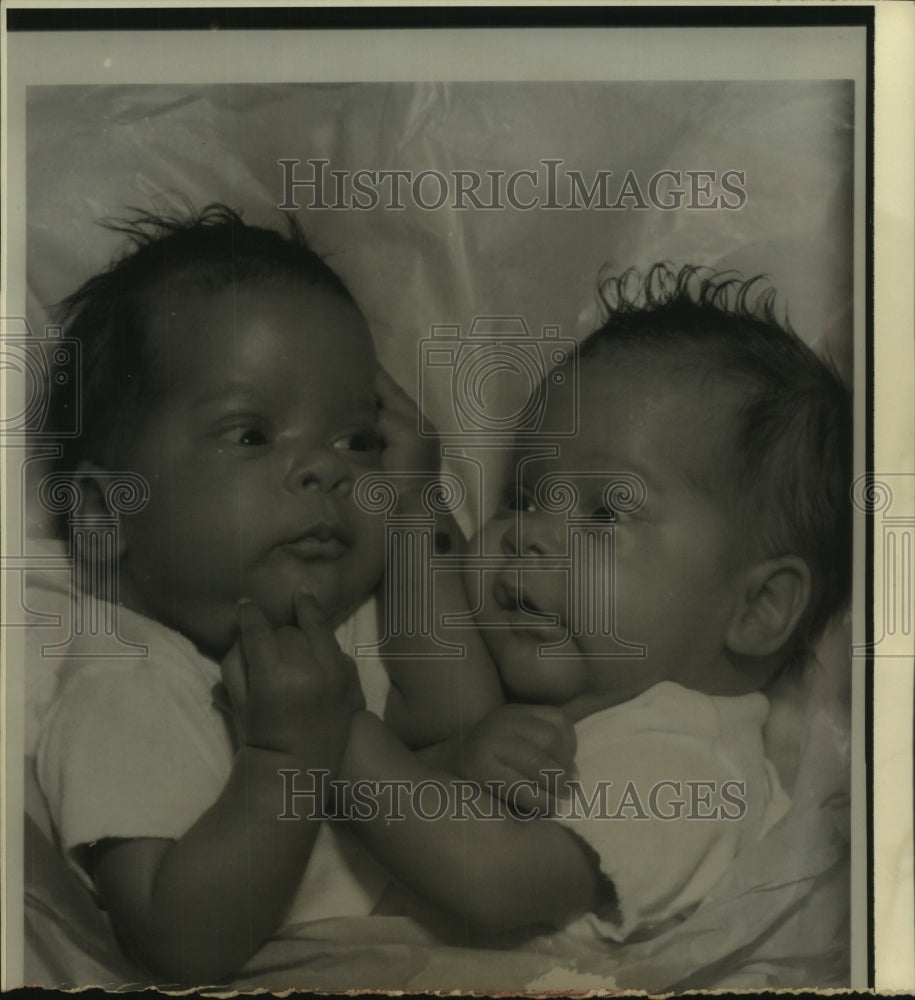 1976, Wichita Siamese twin girls to be surgically separated - Historic Images