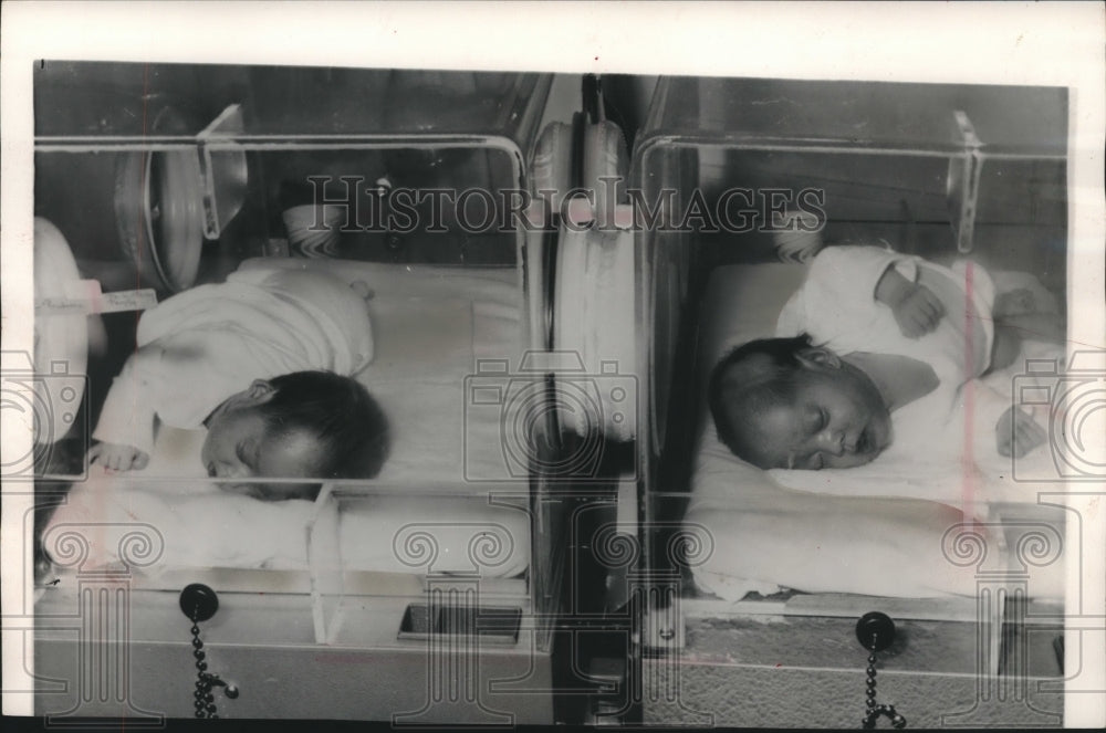 1962 Press Photo Prudence, Patricia separated Siamese twins, California.-Historic Images