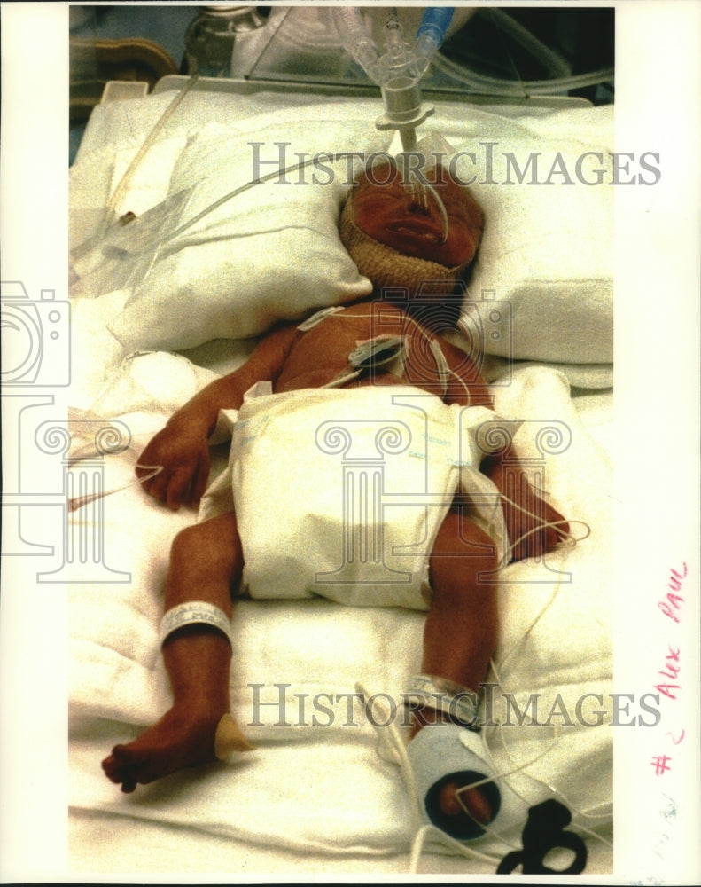 1992 Alex Paul Seibel of Fond du Lac Wisconsin premature birth photo - Historic Images