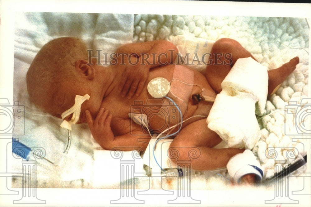 1992 Catherine Jo Seibel, quintuplet at hospital, Wisconsin-Historic Images