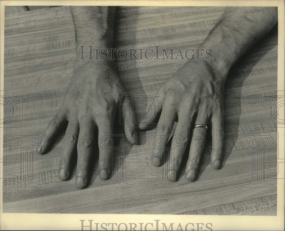 1985 Press Photo Hands of Criminal Anthony Pipito - mjc29037 - Historic Images