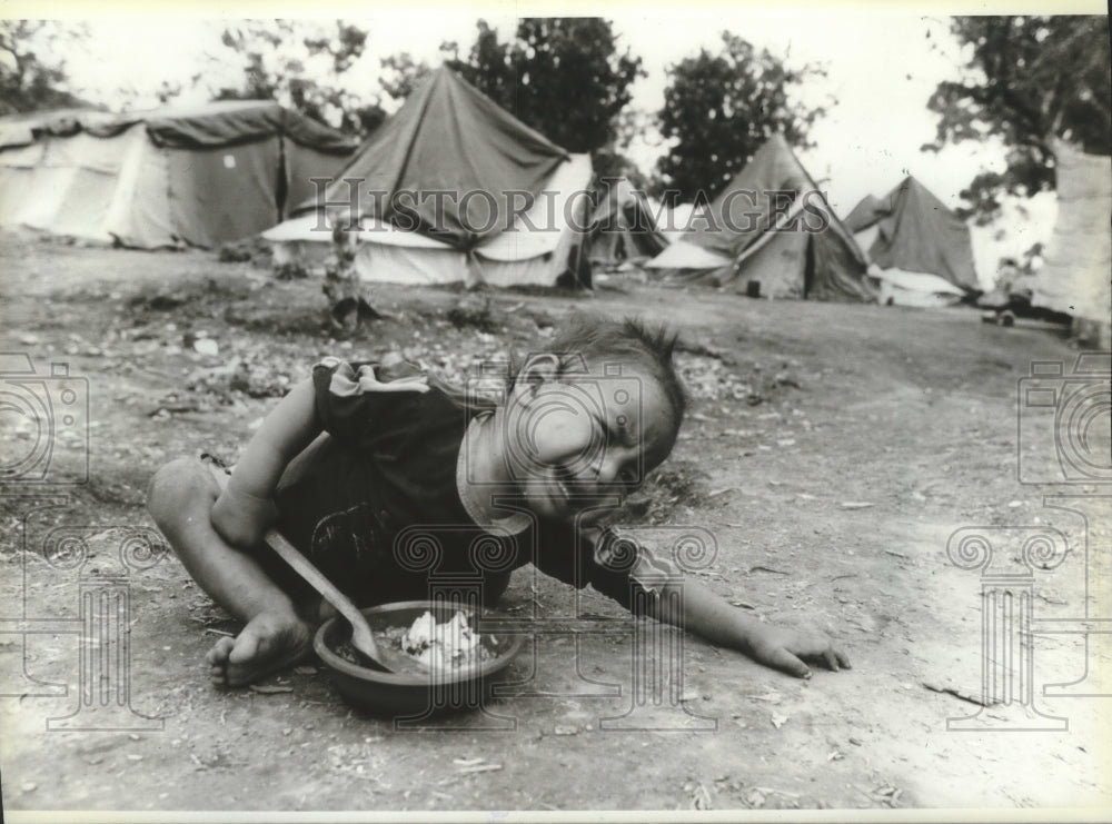 1983 Nicaraguan 18 month old refugee child reaches for food-Historic Images
