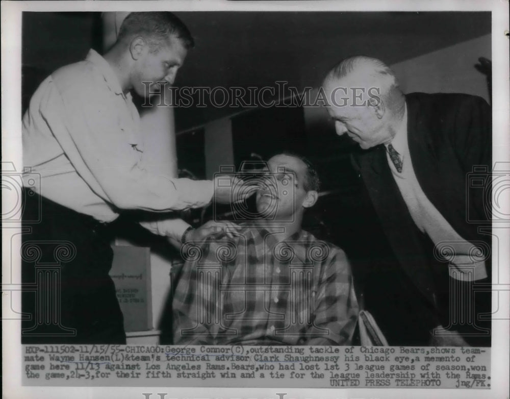 1955 Bears Tackle George Connor Shows Black Eye To - Historic Images