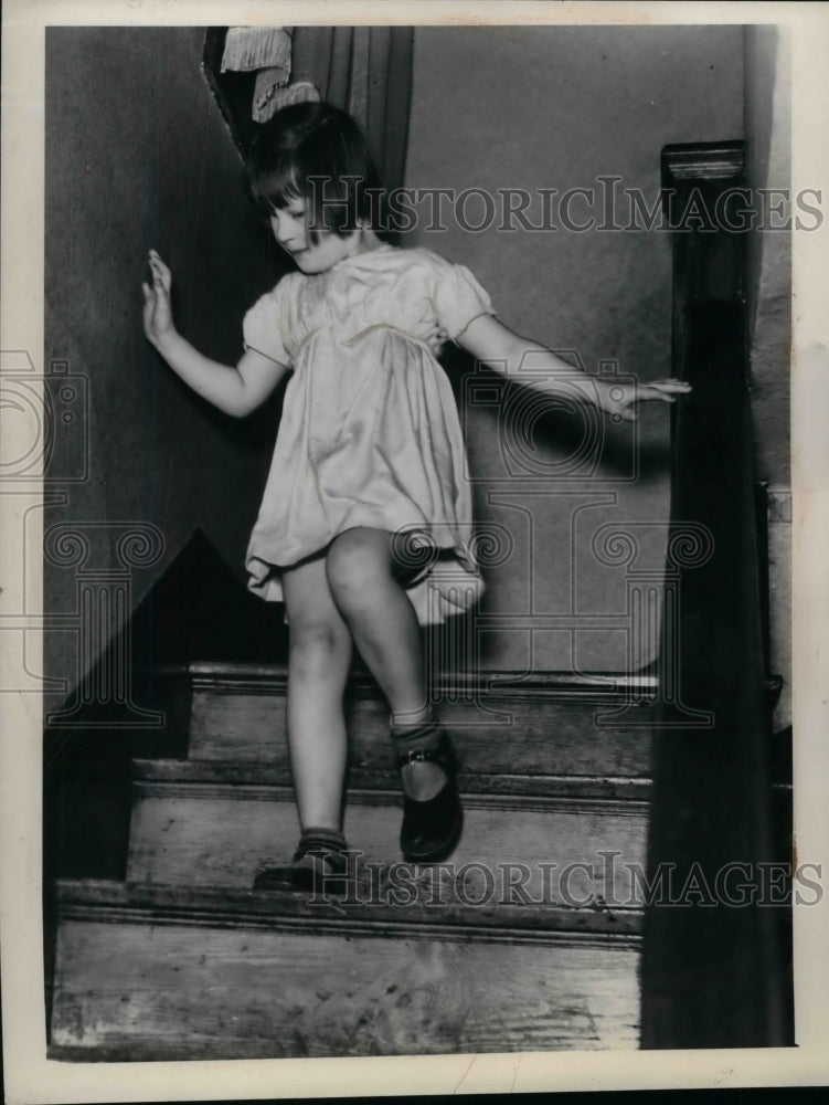 1938 Press Photo Alice Louise Querry 5 years old 1 eye removed due to cancer-Historic Images