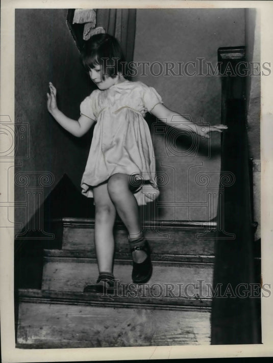 1938 Press Photo Alice Louise Querry 5 years old 1 eye removed due to cancer-Historic Images