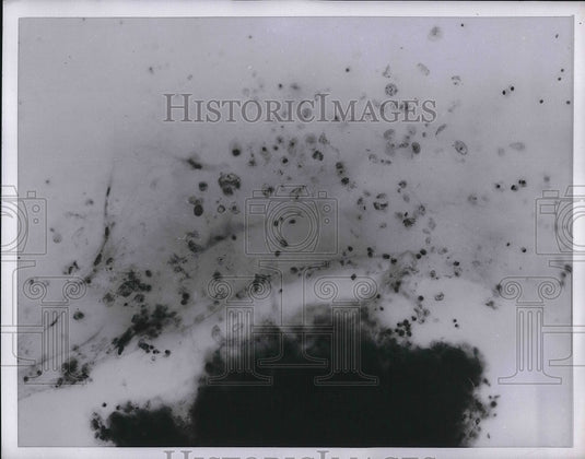 1954 Press Photo Closeup of cancer cells after treatment - Historic Images