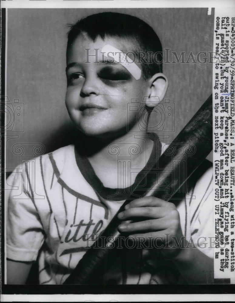 1959 Press Photo Jimmy Furches 7 Yrs Old Holds Bat W/ Black Eye From Flying Bat - Historic Images