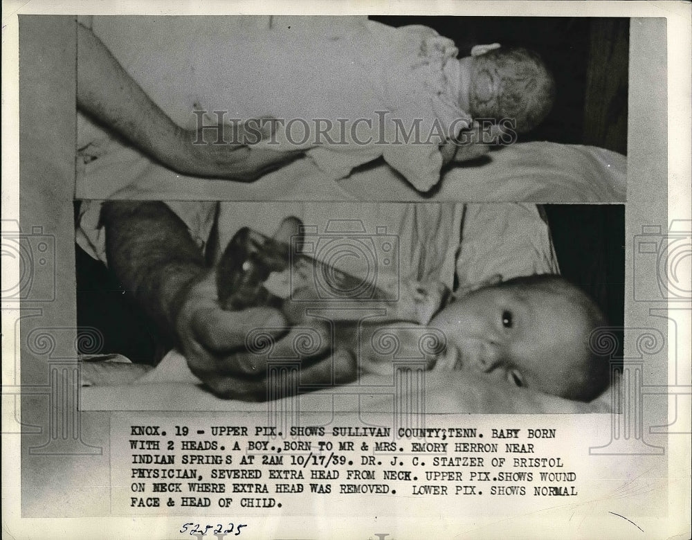 1939 Press Photo Son of Mr & Mrs Emory Herron Born with 2 Heads - Historic Images