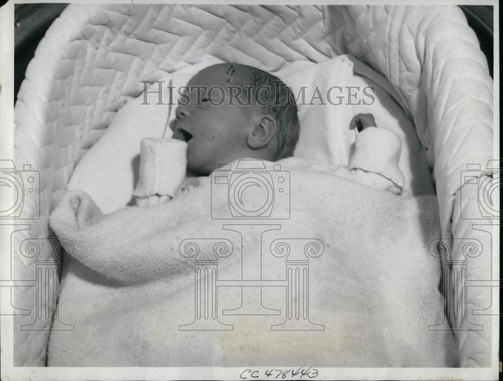 1938 Press Photo Baby Hale after emergency operation - nea50615 - Historic Images