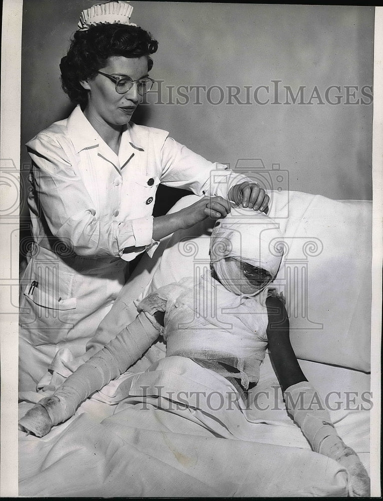 1946 Joanne Spears Victim Of Fire With Nurse In Hospital  - Historic Images