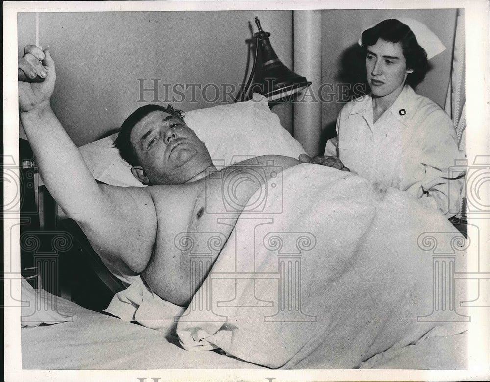 1949 Press Photo Albert Bartells Undergoes Weight Loss Operation - nea63260 - Historic Images
