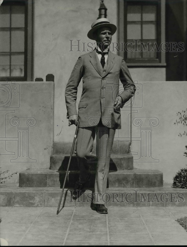 1925 Kay Jorgensen, Man with Partial Leg Missing  - Historic Images