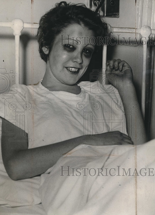 1934 Vivian Mason Beaten By Boyfriend For Refusing To Help Robbery - Historic Images