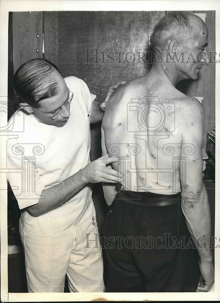 1940 Dr. Rich Johnston examining Elmer Dennis who suffered more than - Historic Images
