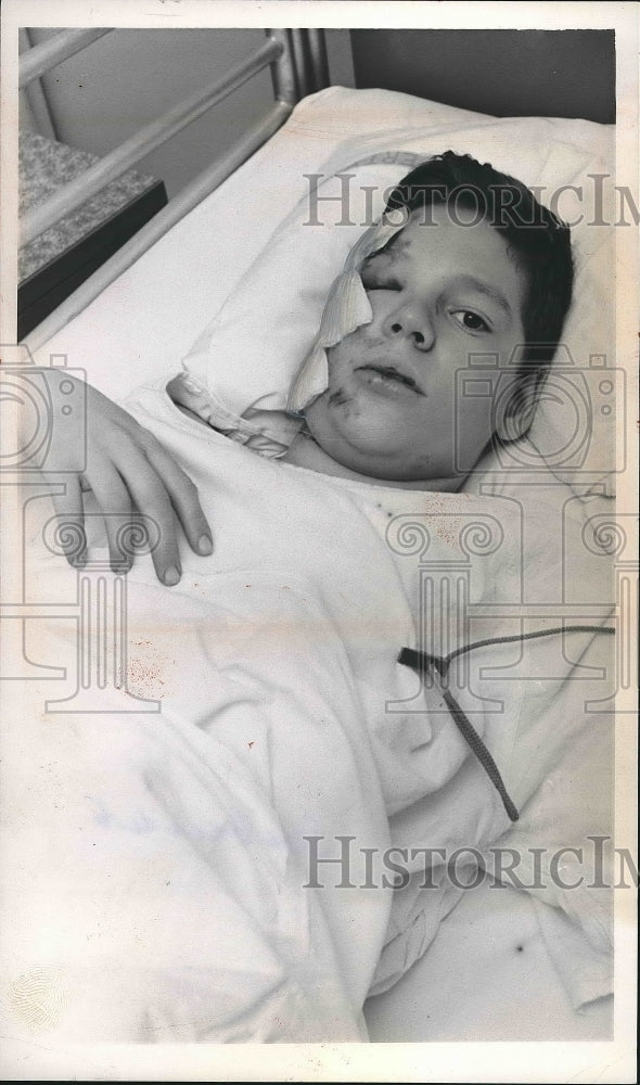 1964 Press Photo Tom Minarik in Hospital After Sled Accident - nea89292 - Historic Images