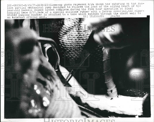 1971 Detroit, Mich 6 in pump to assist ailing heart installed - Historic Images