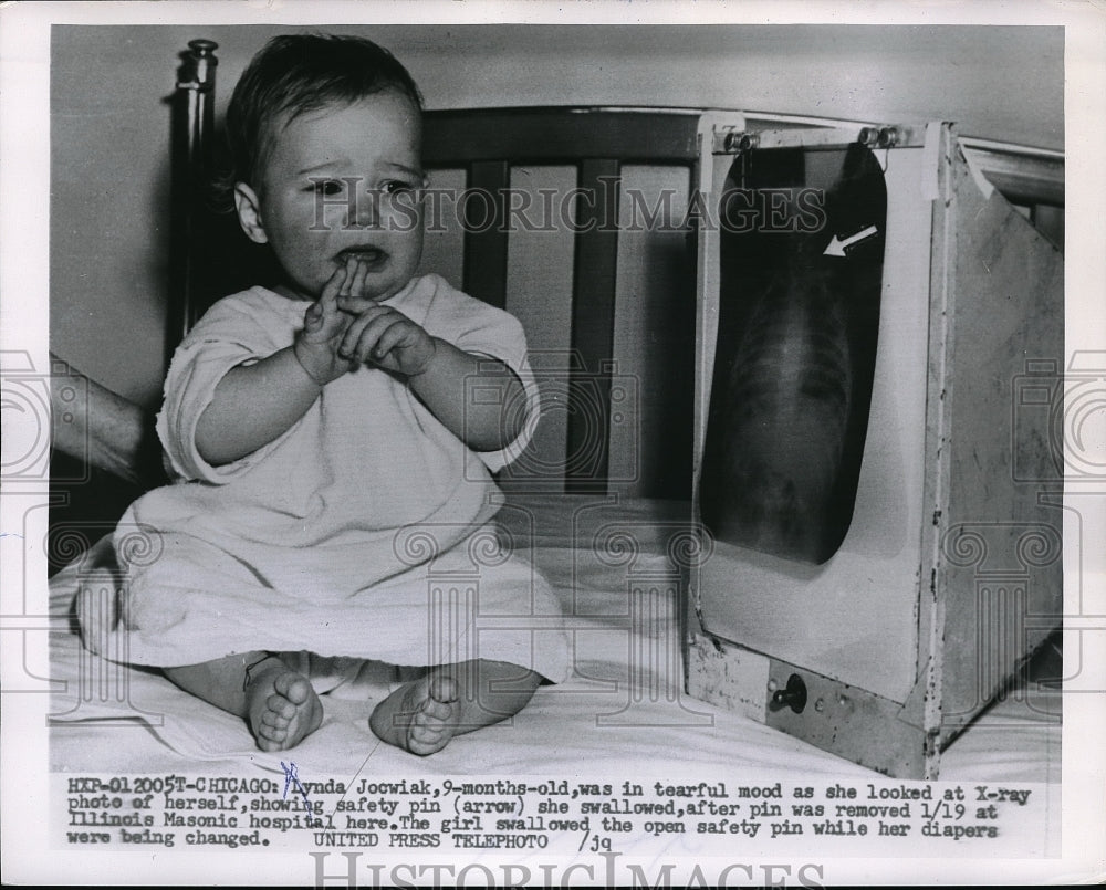 1955 Lynda Jocwiak looking at Xray - Historic Images