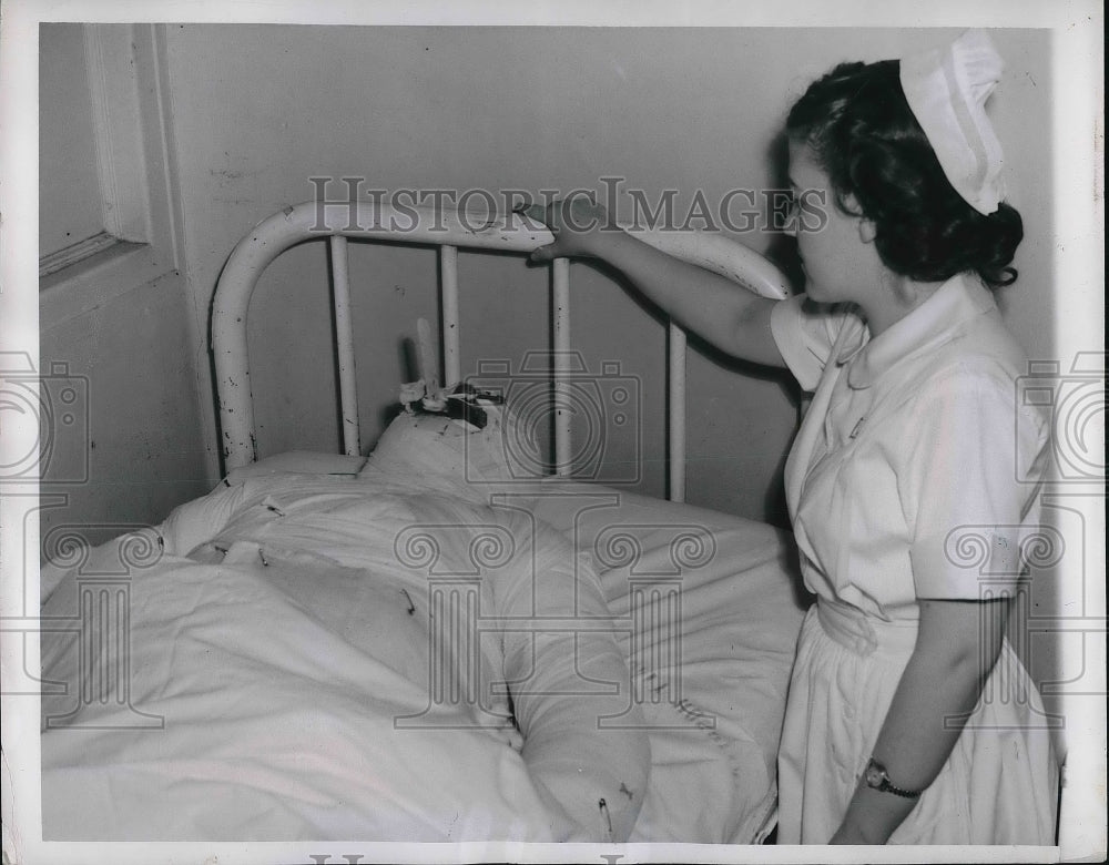 1951 Press Photo Robert Blackmore in Critical Condition After Explosion - Historic Images