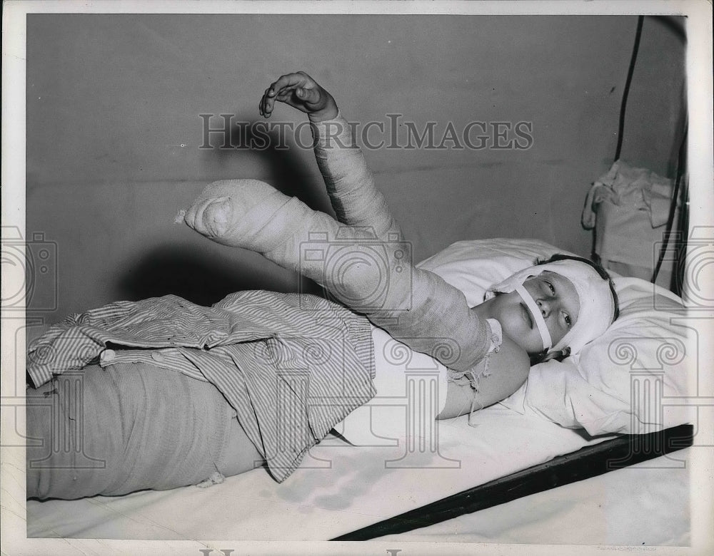 1947 Press Photo Diana Dahlberg, 11, being treated for severe burns - Historic Images