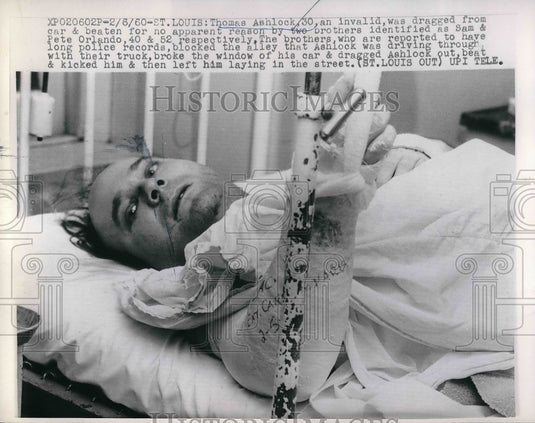 1960 Press Photo Thomas Ashlock was dragged from car & beaten for no apparent - Historic Images