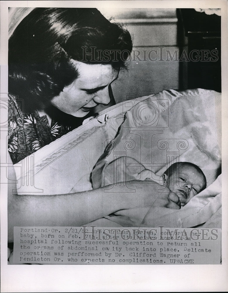 1952 Press Photo Mrs Arthur Warren Infant Had Surgery - Historic Images