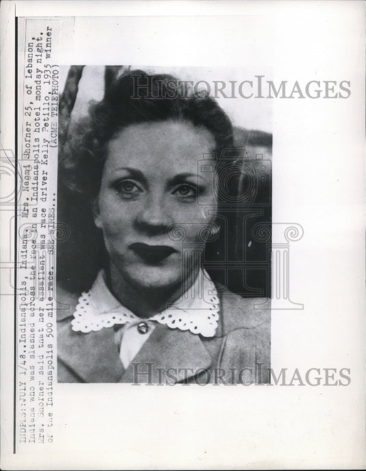 1949 Press Photo Mrs Naomi Shofner Indianapolis Indiana Victim Of Stabbing-Historic Images