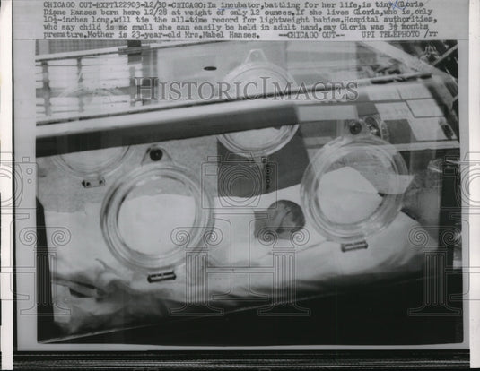 Press Photo Diane Hanses In Incubator - Historic Images