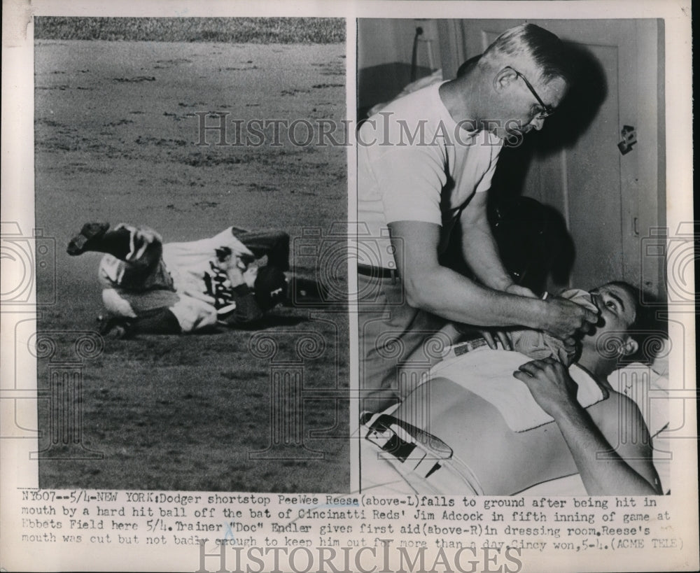 1951 Press Photo Dodger SS PeeWee Reese Hit In Mouth By Drive Hit By Reds Adcock - Historic Images