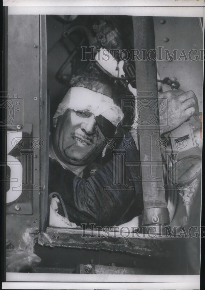 1957 Press Photo William Hochstein rescued from NYC subway train accident - Historic Images