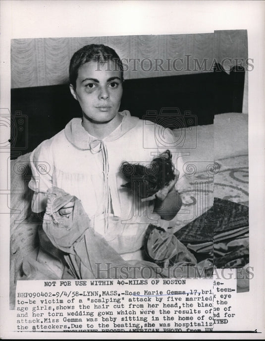 1958 Press Photo Rose Marie Gemma,17, victim of "scalping" attack-Historic Images