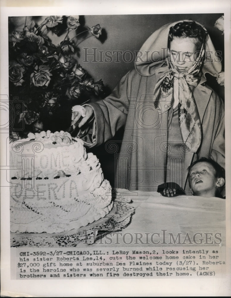 1949 Press Photo Chicago, Ill LeRoy Mason, age 2 & sis Roberta after skin grafts - Historic Images