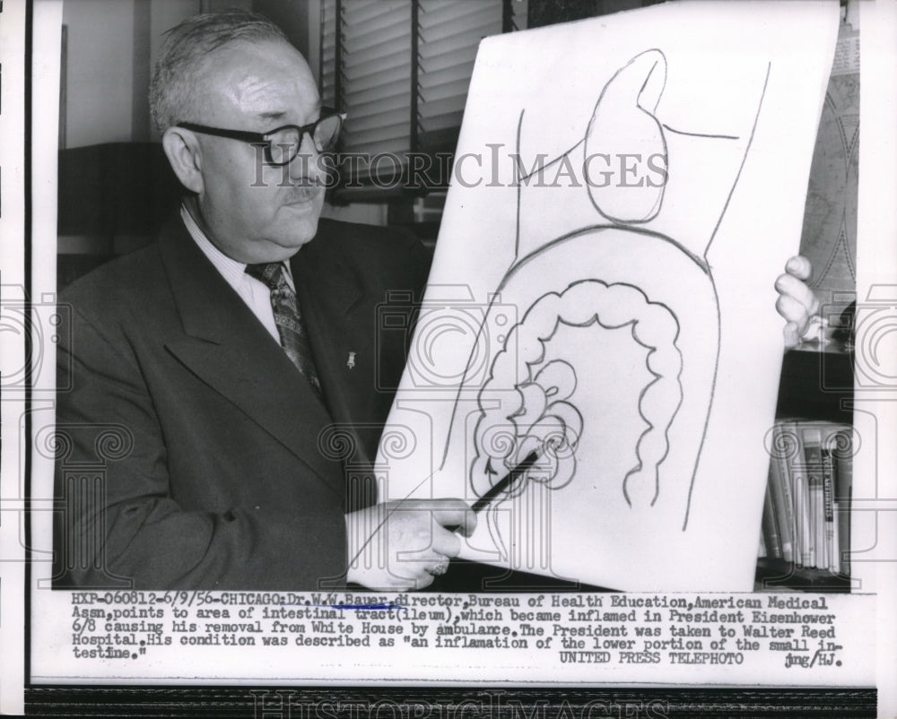 1956 Press Photo Chicago, Ill Der WW Bauer, bureau HEW &amp; intestine diagram - Historic Images