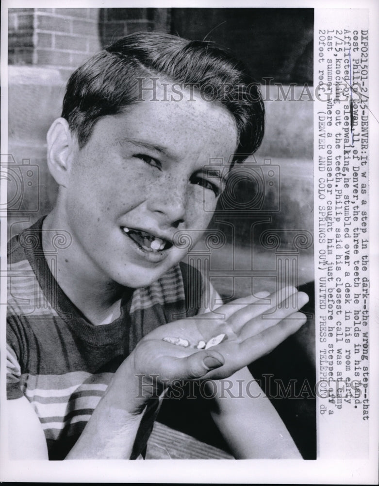 1957 Press Photo Denver, Colo. Philip Cowan, age11 knocked out 3 teeth sleepwalk - Historic Images