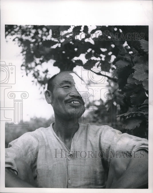 1953 Smiling Korean After Treatment on Face-Historic Images