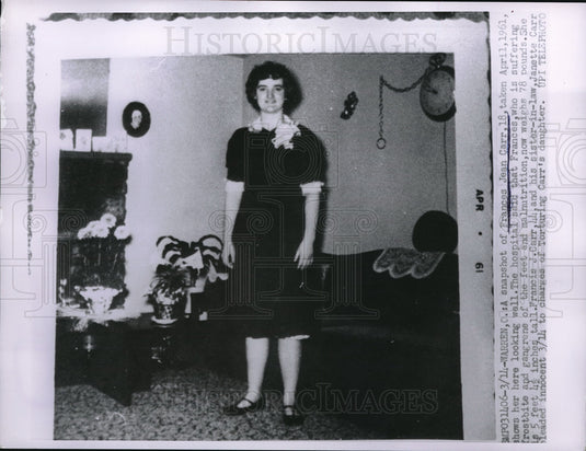 Press Photo Frances Jean Carr after recovering from frostbite now weighs 78 lbs - Historic Images