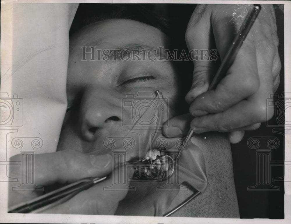 1936 Dr. LeRoy Hartman dulling Dentin in Teeth Dentist Edd Johnson-Historic Images