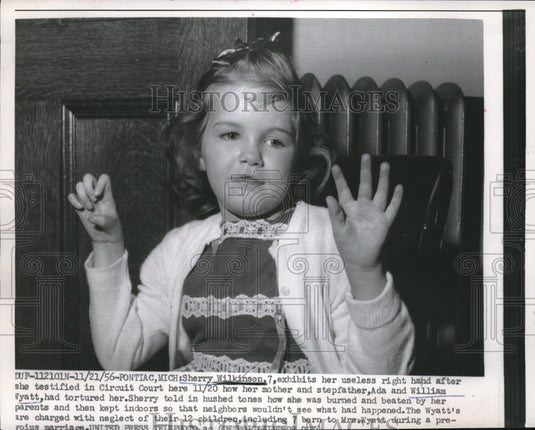 1956 Press Photo Sherry Wilkinson Shows Useless Right Hand As She Testifies - Historic Images