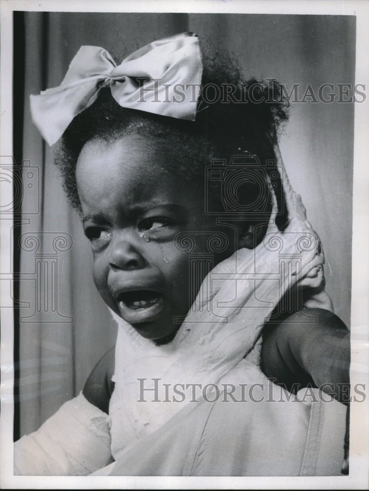 1959 Press Photo One year old Karmyn Duncan in cumbersome cast - Historic Images