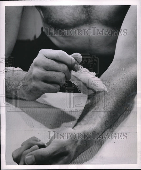 1954 Press Photo Aerosol Spray Dressing For Injured Area of Skin-Historic Images