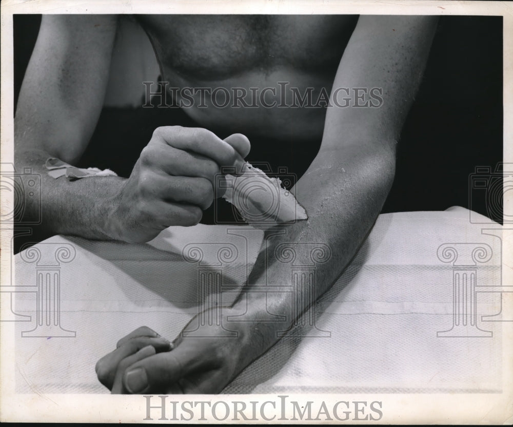 1954 Press Photo Plastic and Spraying Surgical Dressing - Historic Images