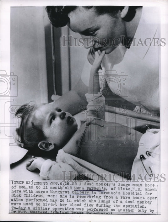  Mona Parson Saved By Dead Monkey's Lung, Nurse Margaret Calbery - Historic Images